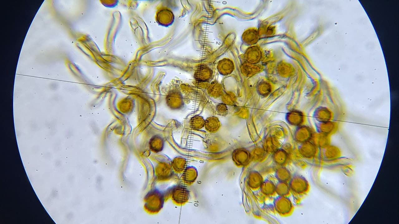 Esporas de hongos micorrícicos bajo microscopio